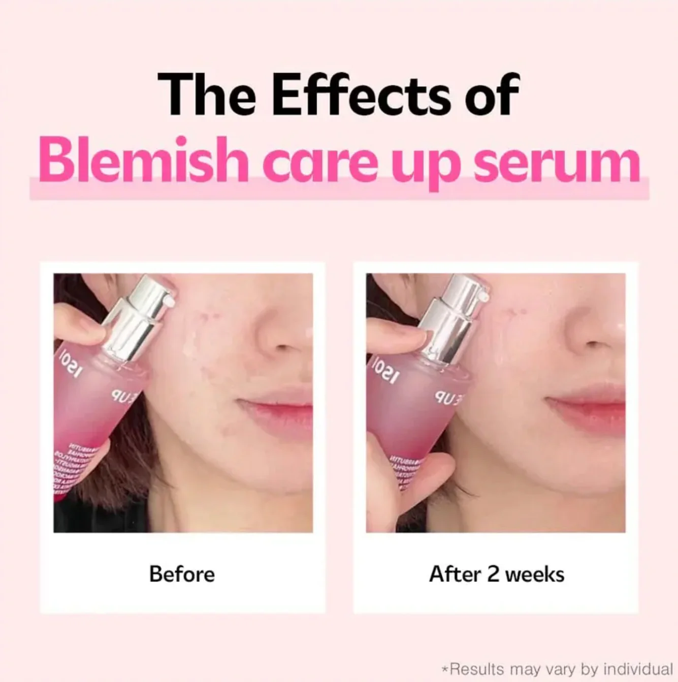 ISOI Blemish Care Up Serum 35mL - Image 9