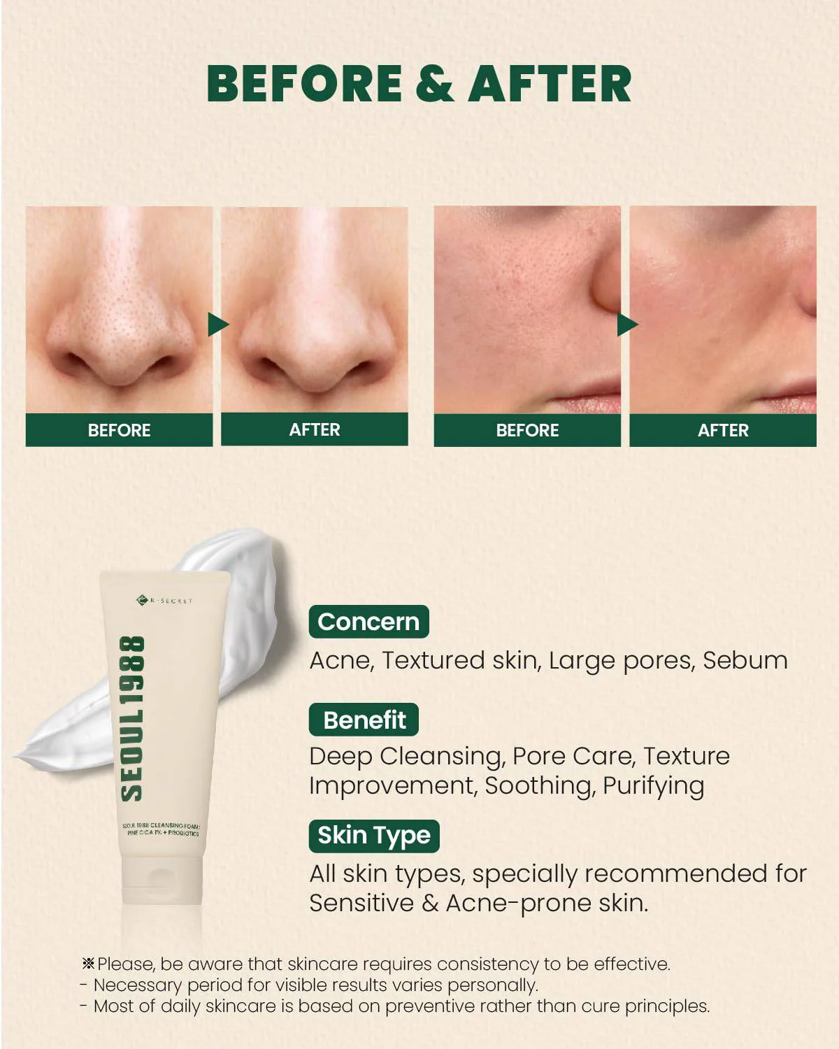 KSECRET Seoul 1988 Cleansing Foam: Pine Cica 1% + Probiotics 150mL - Image 6