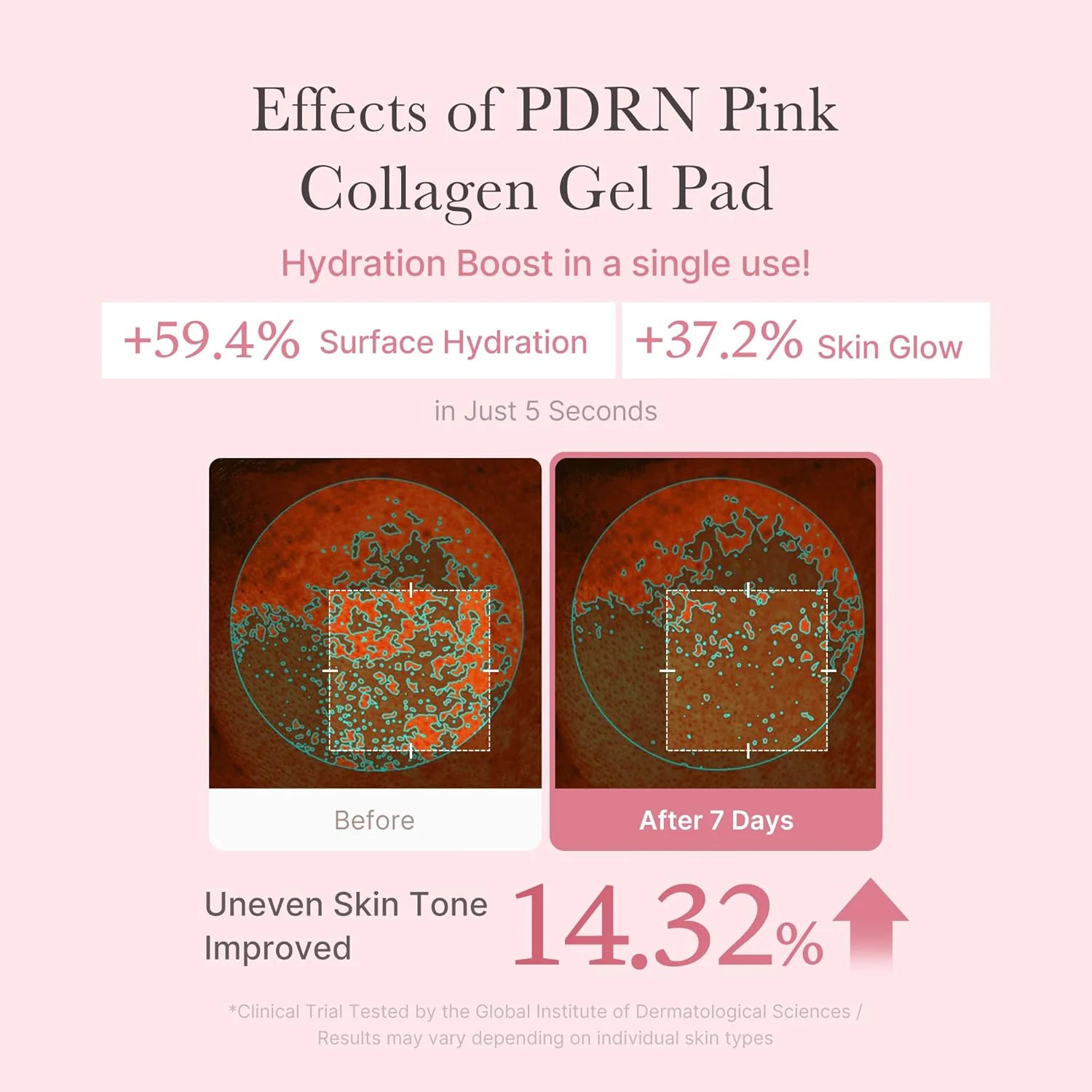 MEDICUBE PDRN Pink Collagen Gel Toner Pad 120mL (70 Pads) - Image 7