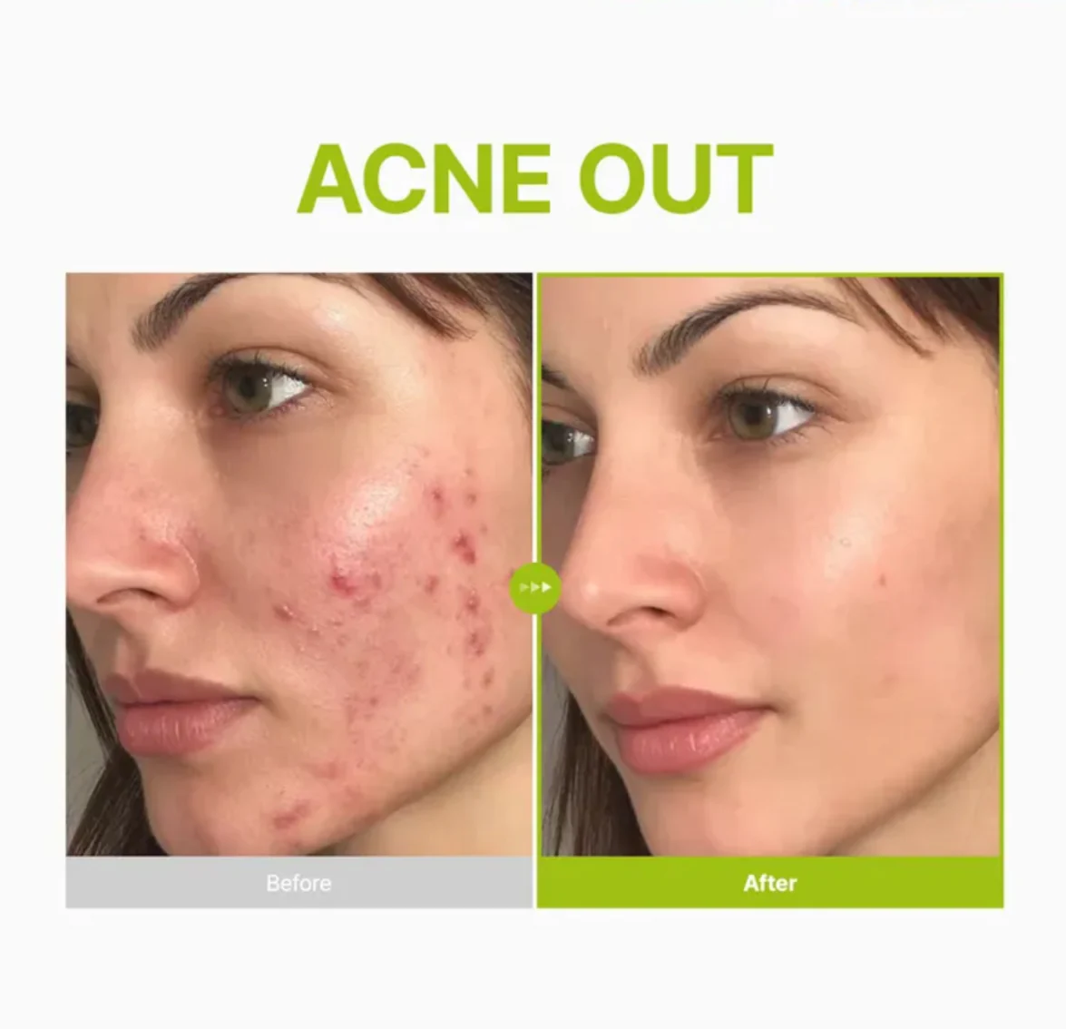 PURITO SEOUL Azelaic Acid 10 Kojic Tea Tree Serum 30ml - Image 5